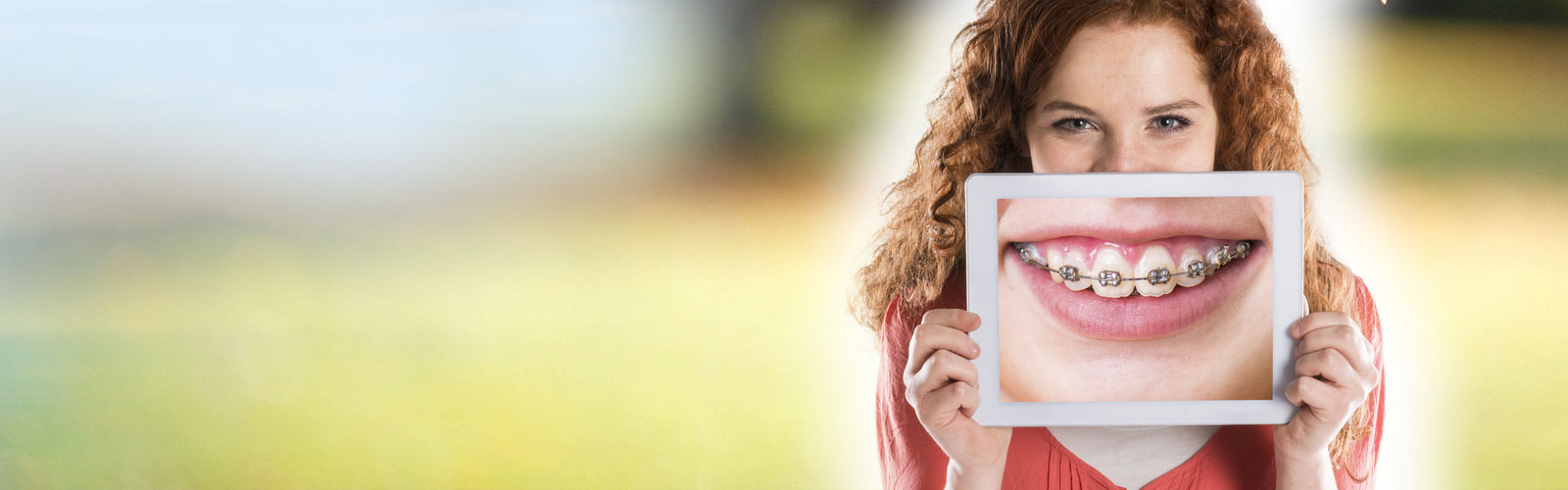 Redwood City Types of Braces