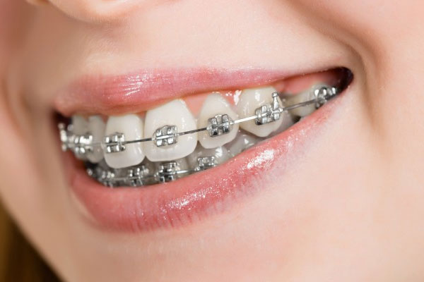 Dr Steven Yatrofsky (Orthodontist)