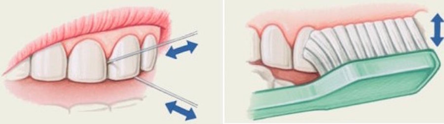 Orthodontics Brushing And Flossing