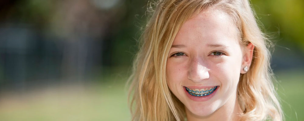 Redwood City Orthodontics Redwood City Orthodontics