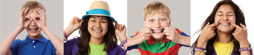 Types of Braces Types of Braces